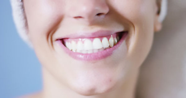 The Steps Of A Dental Crown Restoration